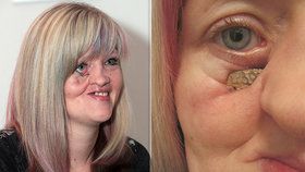 Mirka je o krok blíž k uzdravení.