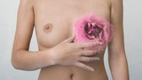 Rakovina varlat a prsu: Dá se vyléčit, když se objeví včas!