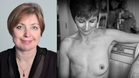 Blesk.cz proti rakovině: Ptejte se na možnosti léčby karcinomu prsu doc. MUDr. Petry Tesařové