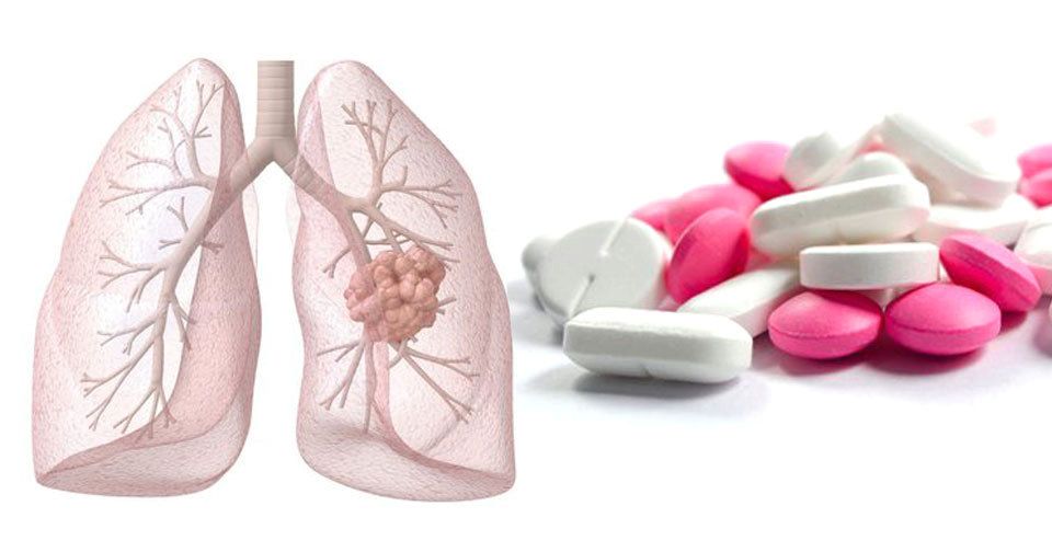 Ibuprofen napomáhá snížení rizika onemocněním rakoviny plic.