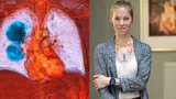 Mámě Lucii (38) rakovinu plic odhalili až v pokročilém stádiu: Smrtelná nemoc přišla tiše