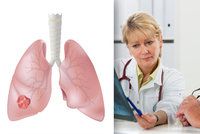 Rakovina plic: 8 z 10 nemocných Čechů umírá!