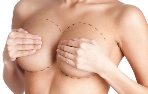 Nezanedbávejte prevenci: Žena chtěla silikony, zjistili jí rakovinu prsu