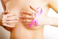 Největší mýty o rakovině prsou. Neuchrání vás malá prsa ani věk