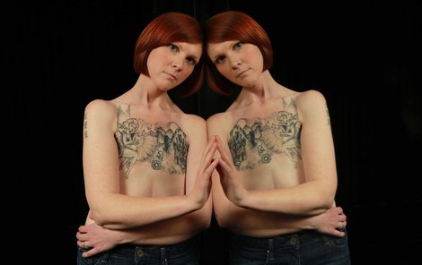 Kelly Davidson ukázala hrudník po amputaci prsou