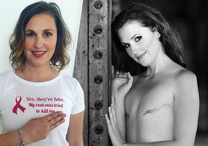 Nikola Samková pomáhá mladým ženám s rakovinou prsu.