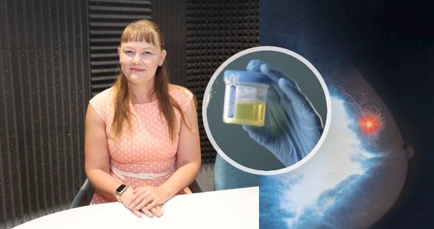 Onkoložka Barbora Englcová varuje před některými alternativními praktikami léčby rakoviny prsu.