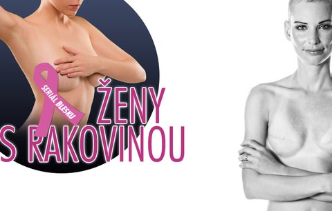 Petra (33) o rakovině: Bulku na prsu jsem si našla den před Vánocemi!