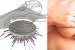 Zařízení ve tvaru misky o průměru asi 25 cm rotuje kolem prsu pacientky. Každou desetinu sekundy osvětlí prsní tkáň baterií laserových děl a zaznamená vzniklou tlakovou vlnu pomocí až 512 ultrazvukových senzorů.