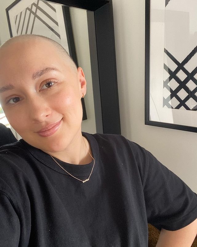Samantha Weilyová z australského Brisbane rakovinu porazila. Nyní nabádá ostatní ženy, aby poslouchaly své tělo.