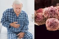 Rakovina slinivky v tichosti bují i 10 let: Odhalit by ji mohl krevní test!