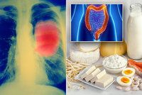 Jídlem proti nádorům žaludku? Odborníci řekli, co vás ochrání před rakovinou