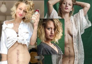 Fotografka Lucie Levá bojuje s rakovinou střev a metastázemi v játrech.