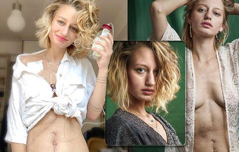 Fotografka hvězd Lucie (28) bojuje s rakovinou: Na nemoc se přišlo pozdě! Kráska přidala dojemný vzkaz