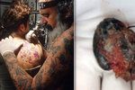 Myslela si, že má rakovinu, ve skutečnosti ale její imunitní systém reagoval na její 15 let staré tetování. (Ilustrační foto)