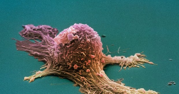 Rakovina vaječníků