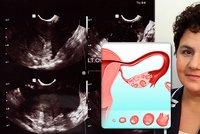 Lékařka Sausen přežila rakovinu vaječníků: Tichý zabiják roste nenápadně, varuje!