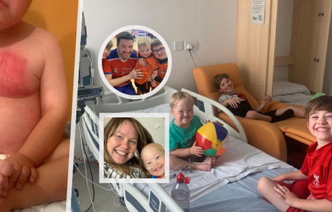 Z neškodné vyrážky se vyklubala rakovina! Chlapec (3) bojuje o život