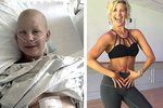 Silná Emilee na fotografii během rakoviny a po ní. To je proměna!