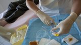 Nová léčba rakoviny: Virem podobným vzteklině