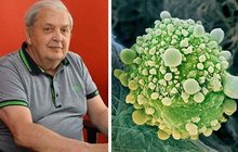 Rakoviny v Česku přibývá: Onkolog řekl proč!