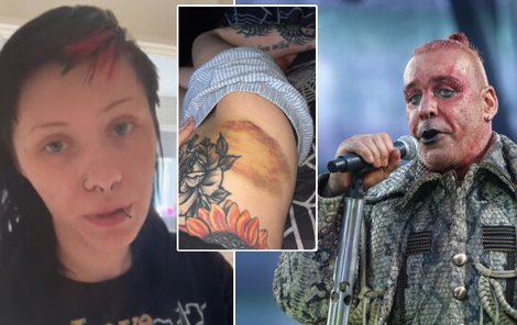 Mladá irská fanynka tvrdí, že ji zpěvák Till Lindemann zdrogoval a pokusil se znásilnit. 