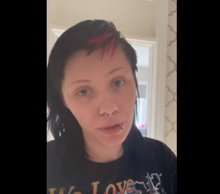 Irská fanynka Shelby Lynn odkryla své modřiny po koncertě Rammstein.