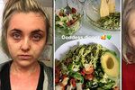 Modelka (22) jí jen ovoce a syrovou zeleninu: Vyléčila si tak silný ekzém, který zapáchal jako hnijící maso!