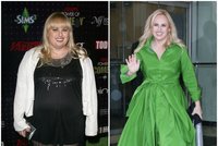 Sculptra a Ozempic: Tajné zbraně celebrit? Proč se o nich (ne)mluví