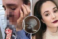 Řidička (24) se snažila chytit klíče od auta: Zabodly se jí do obličeje!