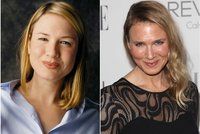 Jsou to vůbec ony? Podívejte se na nepovedené plastiky celebrit