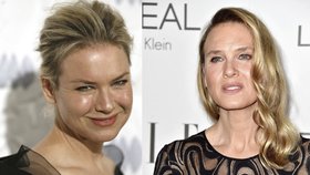 Renée Zellweger to přehnala s chemií, míní experti