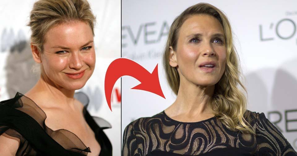 Herečka Renée Zellweger je k nepoznání, změnil se jí obličej a hlavně oči!