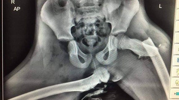 Děsivý rentgen snad konečně odradí lidi od pokládání nohou na palubní desku
