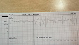 Muž z Nového Strašecí prodělal náhlou zástavu oběhu: Rychlá reakce manželky mu zachránila život!
