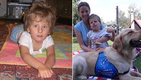 Filípek (8) s vzácnou genetickou nemocí: V Česku  jí trpí jen čtyři kluci! Většina umírá před porodem