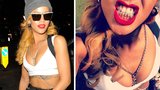 Bláznivá Rihanna opět zasahuje: Všem ukázala své vyšperkované zuby