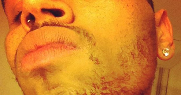 Chris Brown z jedné ze svých bitek vyšel s roztrženou bradou
