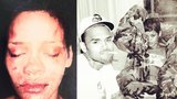 Nepoučitelná Rihanna: Miluji zpěváka, který mi rozbil obličej!