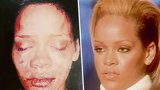 Rihanna (21) konečně promluvila o svém napadení