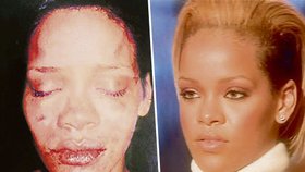 Rihanna: Po a před napadením...