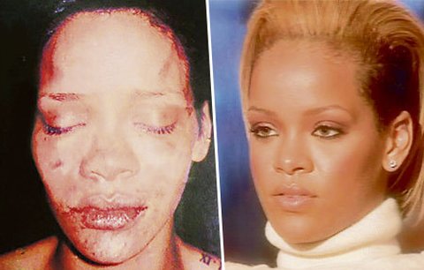 Rihanna: Kráčela jsem s krvavou tváří, nevím kam! 