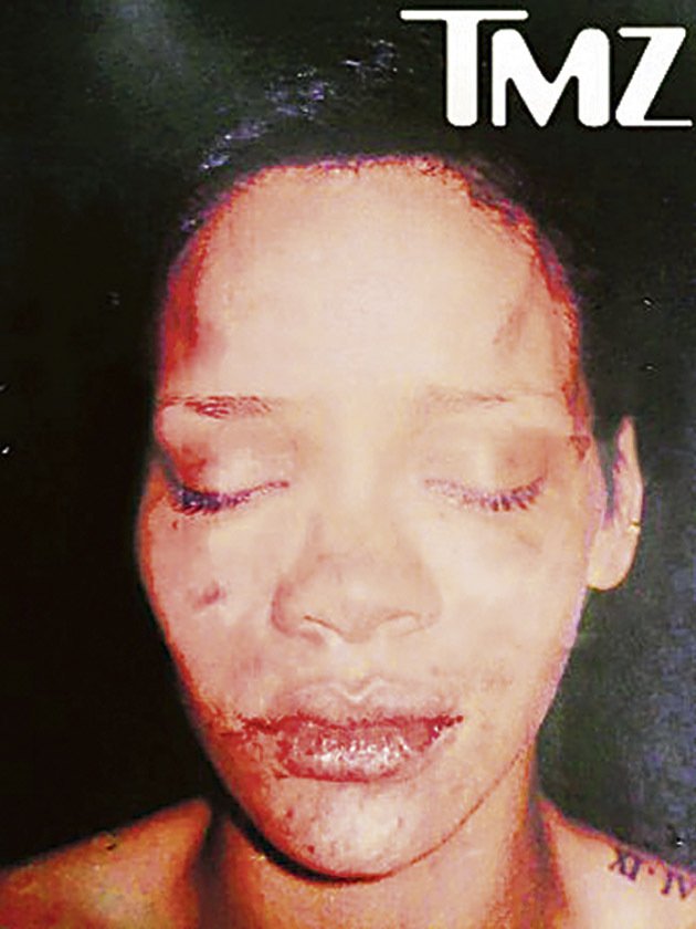Takhle dopadla Rihanna po běsnění milence Browna