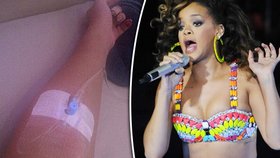 Rihanna musela zrušit několik koncertů. Skončila v nemocnici na kapačkách