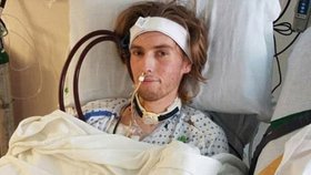 Teenager Riley Hancey (†19) nemohl podstoupit transplantaci, protože měl v těle stopy THC. Při operaci po několika měsících zemřel.