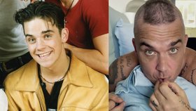Plešatící Robbie Williams přiznal: Za umělé vlasy jsem dal barák! Zbytečně!