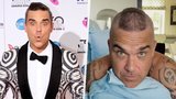 Robbie Williams (47) přiznal, že plešatí: Řídnoucí kštici podpořil zvláštním účesem!