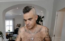 Plešatící Robbie Williams přiznal: ZA UMĚLÉ VLASY JSEM DAL BARÁK!