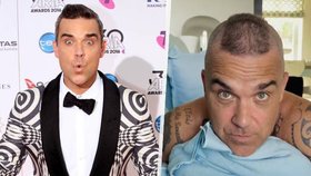 Robbie Williams (47) přiznal, že plešatí: Řídnoucí kštici podpořil zvláštním účesem!