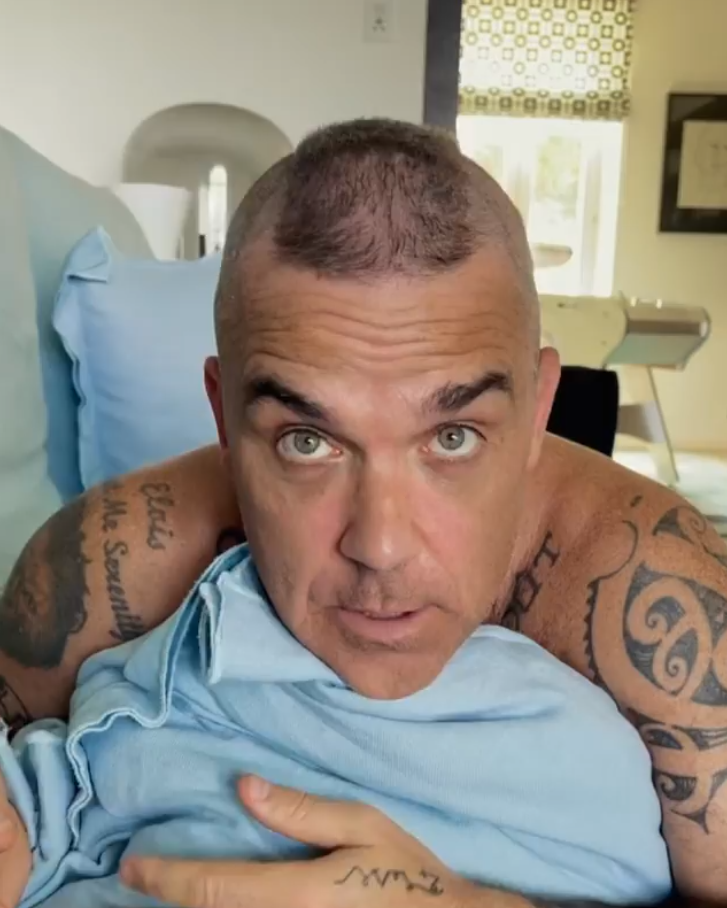 Robbie Williams přiznal, že mu řídnou vlasy